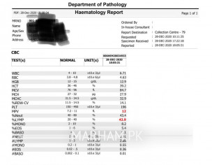 High %LYMP & High MPV In CBC Test