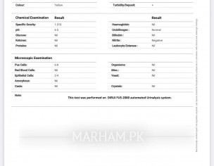 Pregnancy Urine Test