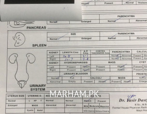 Hepatitis C Reactive 