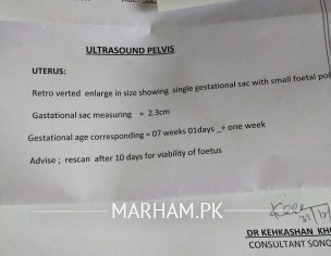 White Creamy Discharge Like Tissues