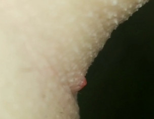 Bump On Armpit?