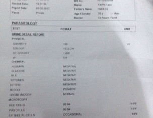 Erectile Dysfucntion