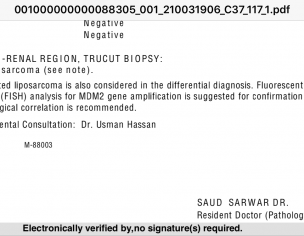 Sarcoma In Abdomen
