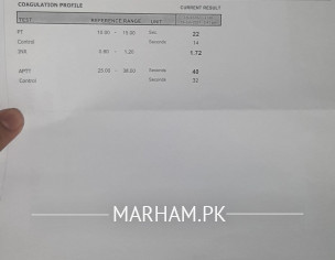 Post CABG ,kidney Issues,