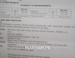 Irregular Pulse 37/45