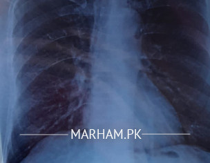 Is There Any Problem In Xray