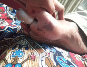 Blood Circulation Problem