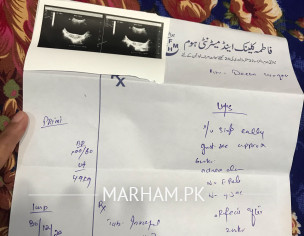 Need Information 