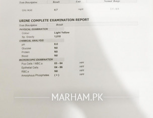 Ù…Ø«Ø§Ù†Û Ú©ÛŒ Ø¯Ø±Ø¯