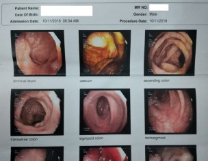 Bowel And Stomach Disorders