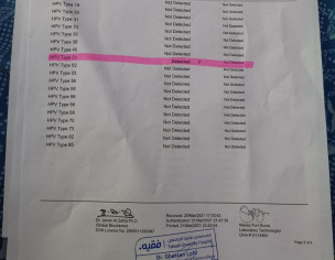 PAP &amp; HPV 51  Is Positive