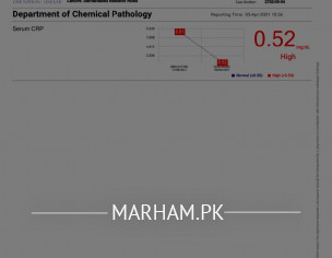 Reports Analysis - Post Fever