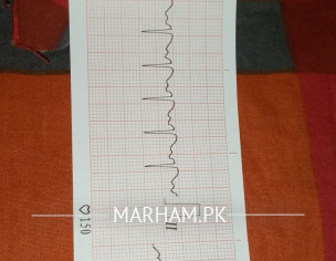 Ecg And Throid Problem