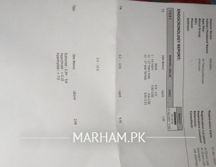 Ecg And Throid Problem