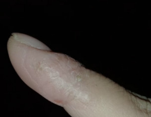 Skin Issue