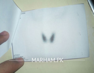 Thyroid Report Check