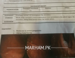 Hiatal Hernia Short Breathing Issues ?