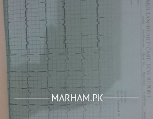 ECG Report Information Required