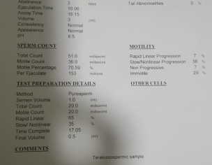 Semen Analysis Report