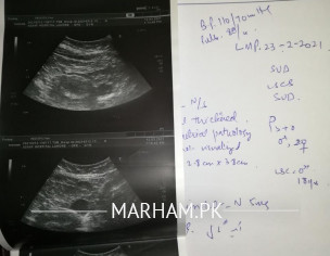 Heavy Bleeding With Blood Clots