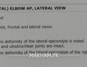 X Ray Report Interpretation.