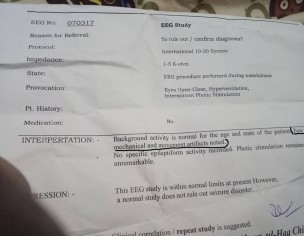 EEG Report