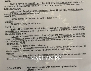 Kidney Stone + Cholelithiasis 