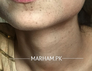 Need Skin Specialist 