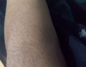 Skin Problem