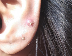 Skin Issues