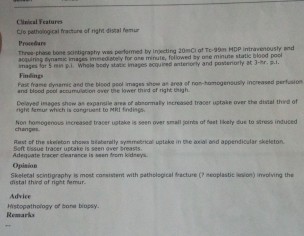 OSTEOGENIC SARCOMA