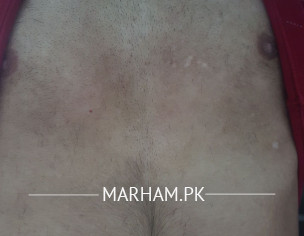 White Spots