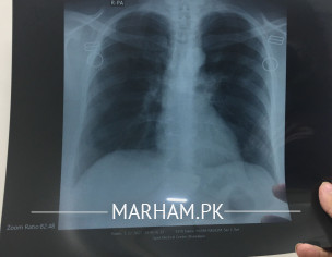 Can Someone Read This CT Scan?