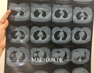 Can Someone Read This CT Scan?
