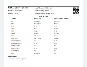 Covid-19, Heart Patient