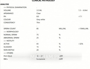 Semans Analysis Test Report