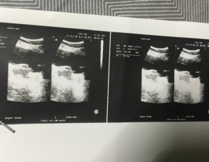 Not Able To Conceive Yet