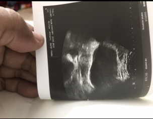 Viable/Healthy Pregnancy?