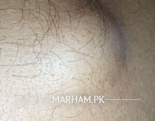 Skin Problem On Back Side