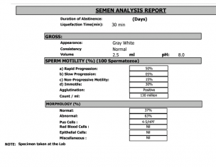 Semen Analysis