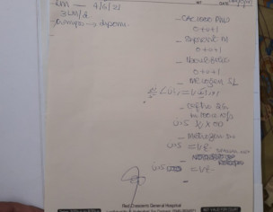 Motion/ Loose Motion