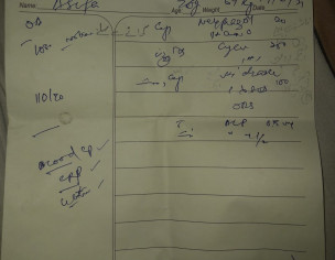 Motion/ Loose Motion