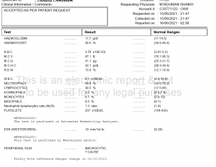 Motion/ Loose Motion