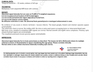Left Temporal Headache
