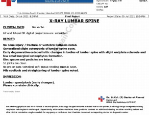 Back Bone Problem