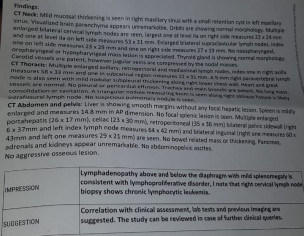 Diagnosed With CLL (stage 3).
