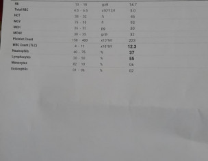 Diagnosed With CLL (stage 3).