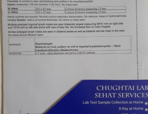 Diagnosed With CLL (stage 3).