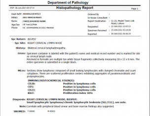 Diagnosed With CLL (stage 3).