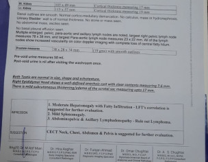Diagnosed With CLL (stage 3).